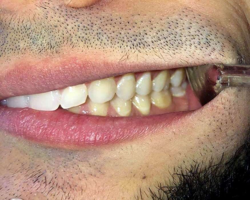 Remote Orthodontic Consultations Dublin Orthodontics